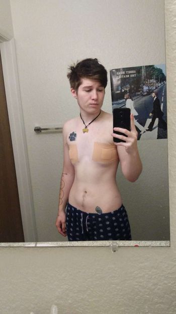 nude faggotclown posting teen selfie